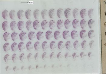 Media type: image;   Special Collections 1911 Description: slide A;